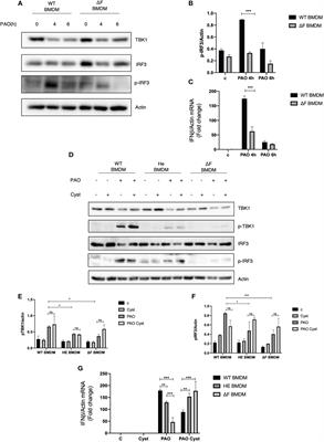 The STING/TBK1/IRF3/IFN type I pathway is defective in cystic fibrosis